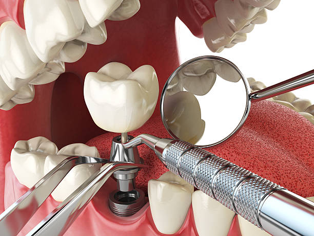 Best Emergency Dental Filling Replacement  in Neshanic Station, NJ